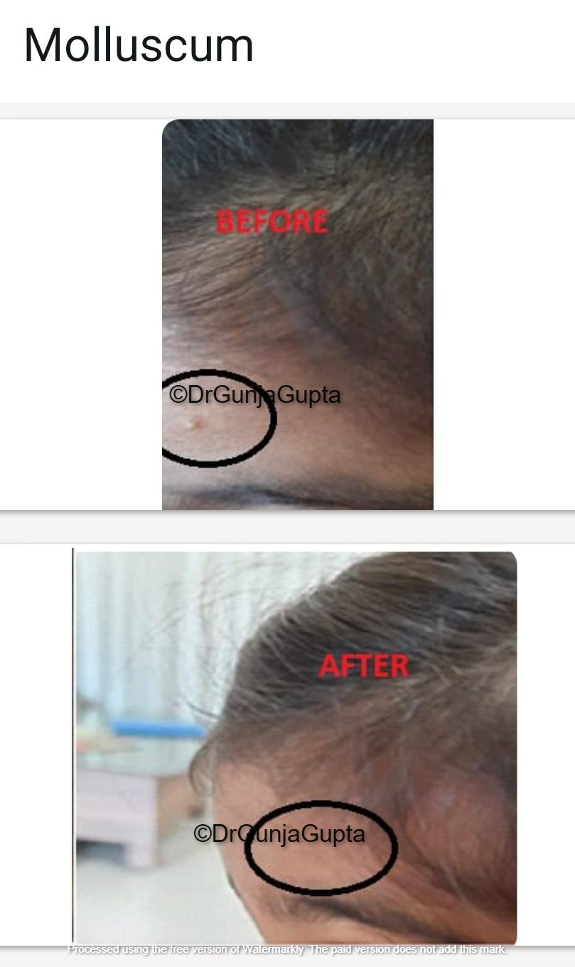Before and After Case 2