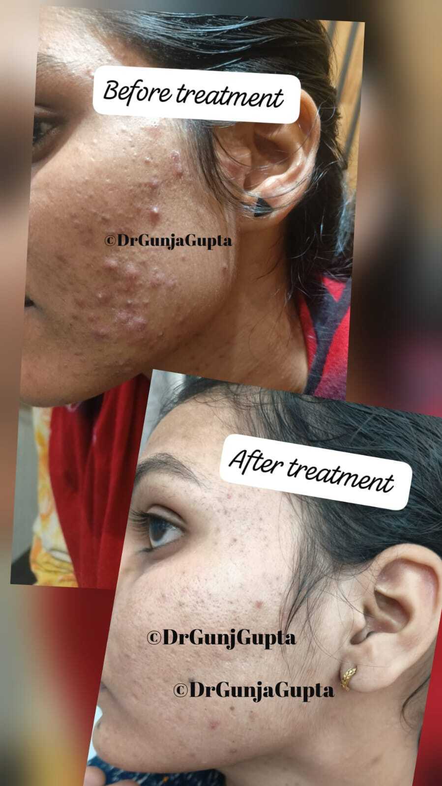 Before and After Case 6